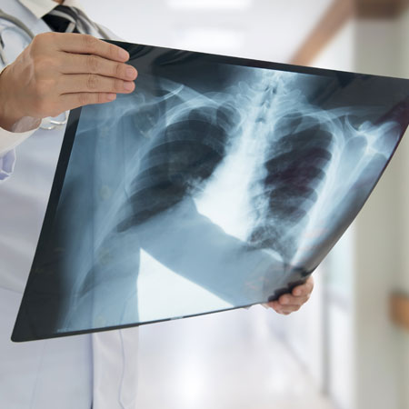 X-Ray