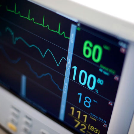 ECG