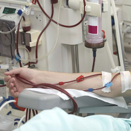 Dialysis